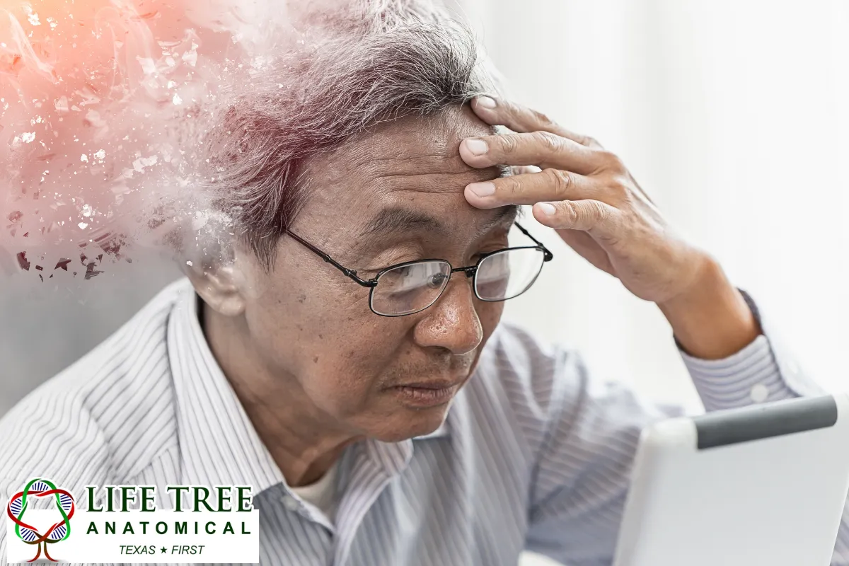 Brain Donation Versus Whole Body Donation in Dementia Cases